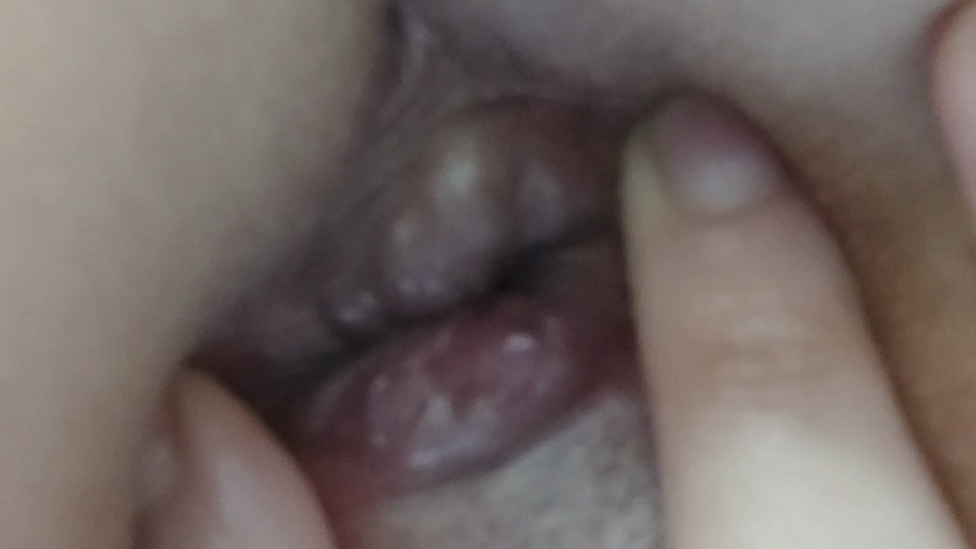 Asshole close up and atm