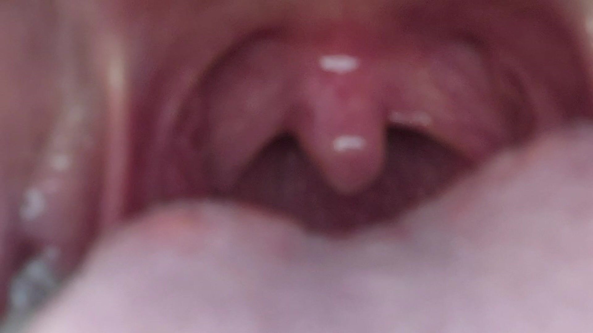 Uvula close