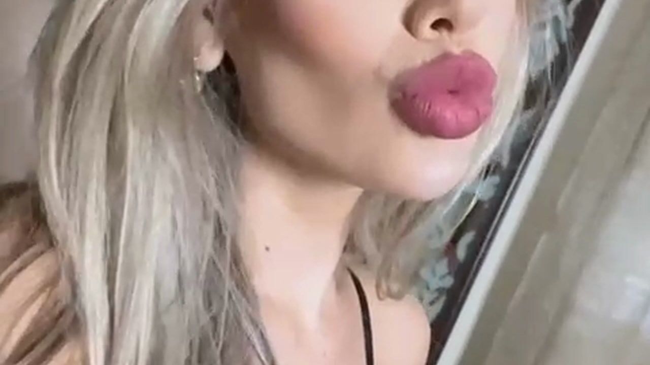 Kisses